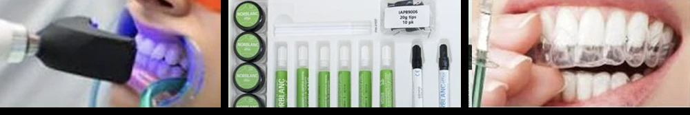 Blanqueamiento dental en Alicante - Clínica dental María Jiménez - Desde 1995