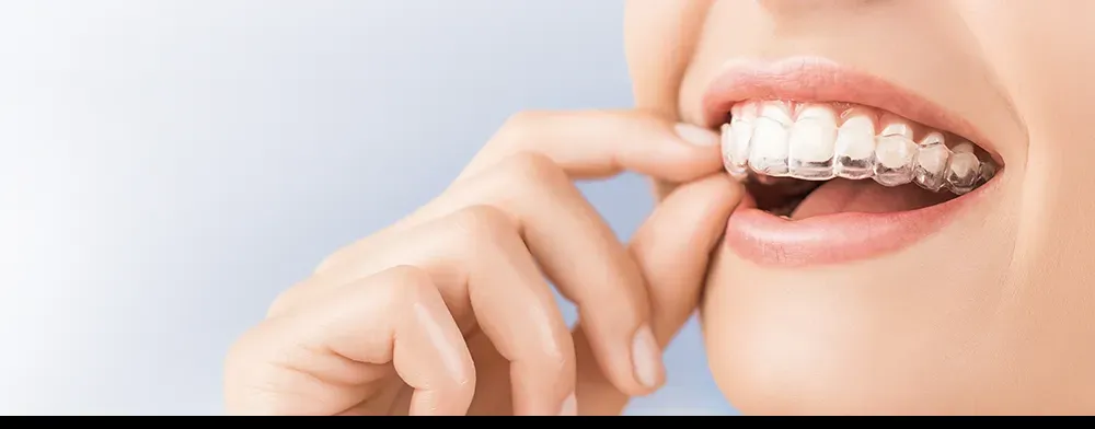 bruxismo protector bucal clinica dental alicante