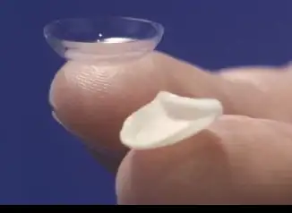 carillas-dentales-lumineers-en-alicante-clinica-dental