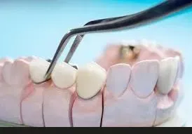 Odontología restauradora en Alicante - Clínica dental María Jiménez