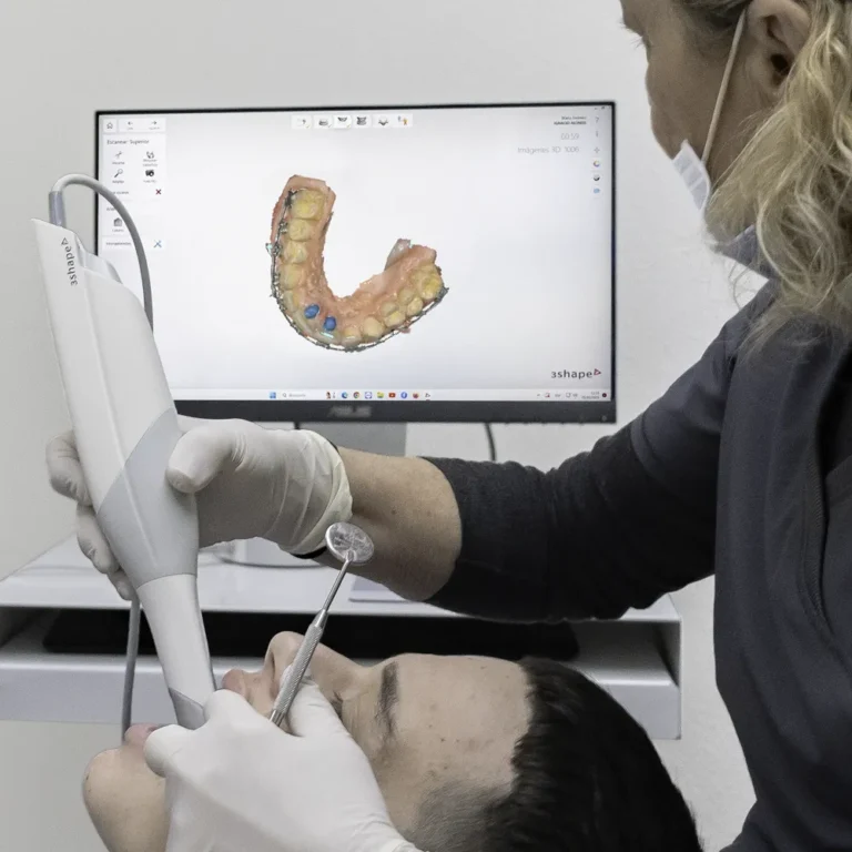 scaner para moldes dentales en Clínica dental María Jimémez en Alicante