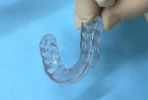 Férula de descarga en Alicante Clínica dental María Jiménez