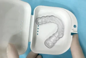 Férula de descarga en Alicante Clínica dental María Jiménez